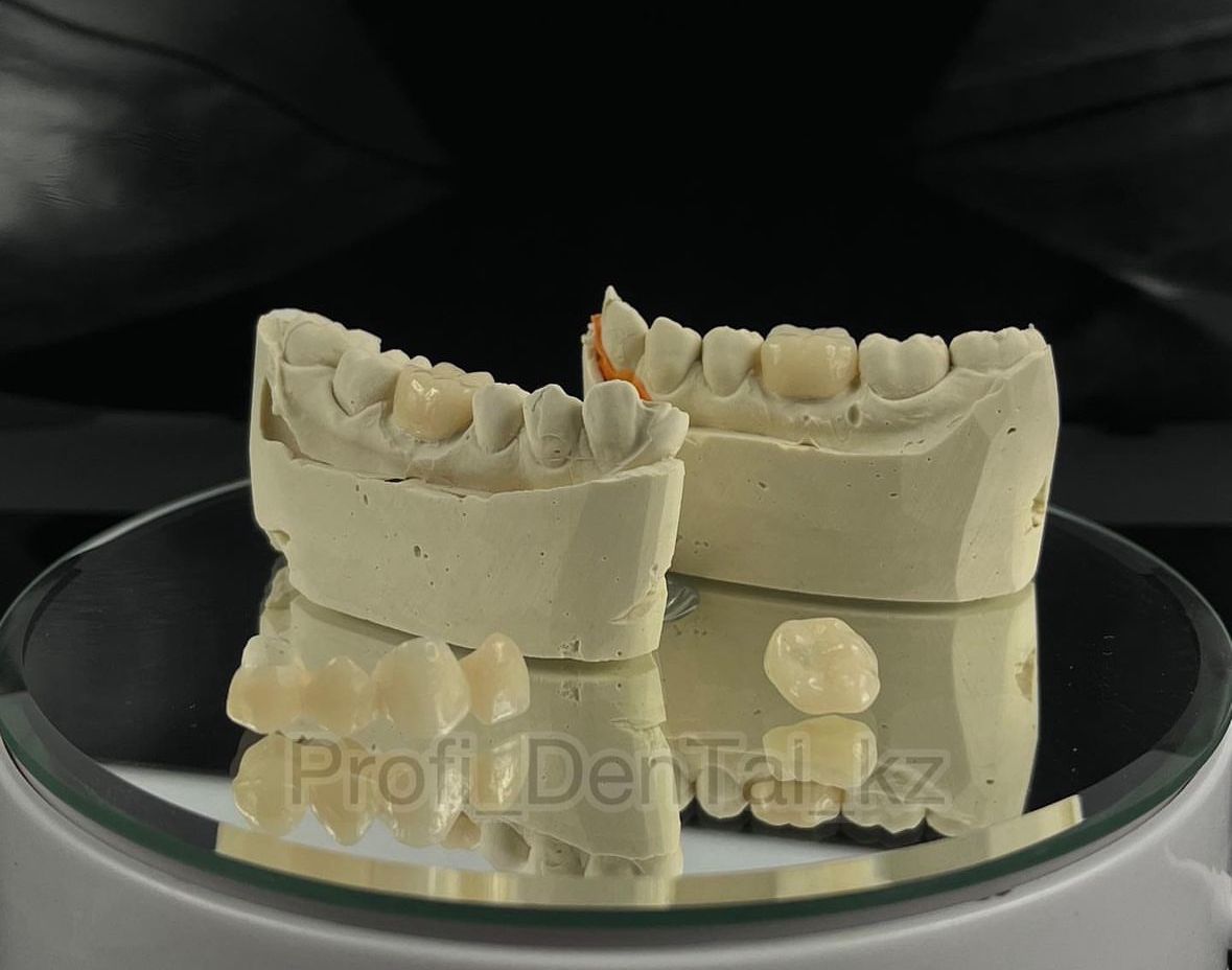 Profi DenTal kz